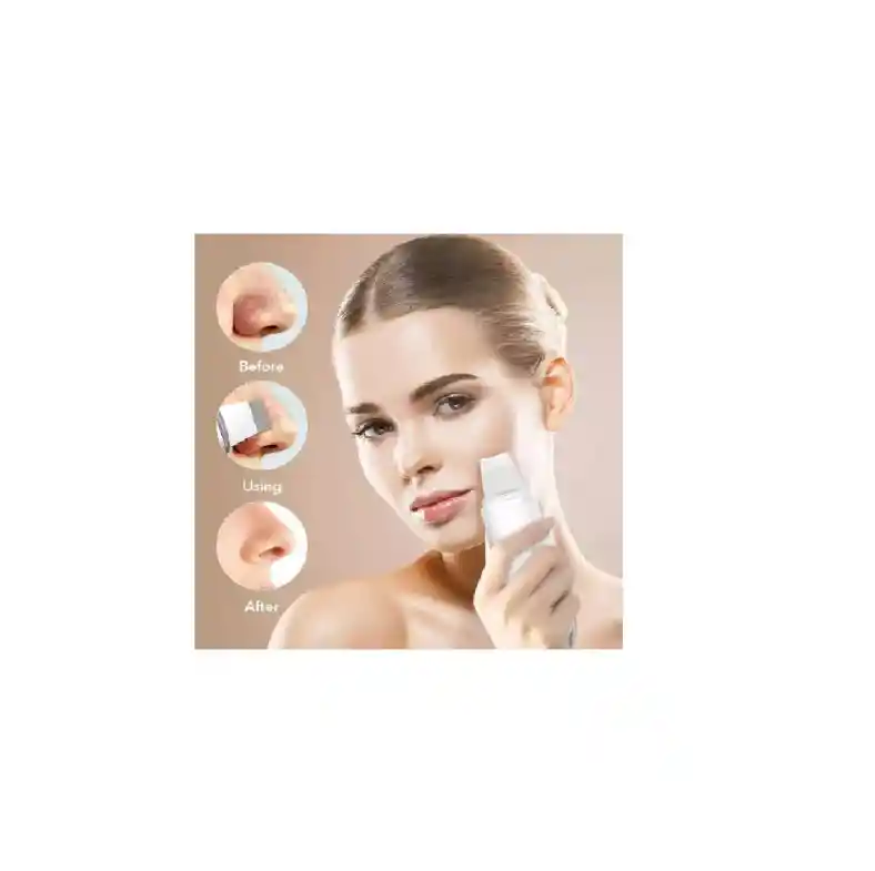 Limpiador Ultrasonido Skin Limpiador Facial