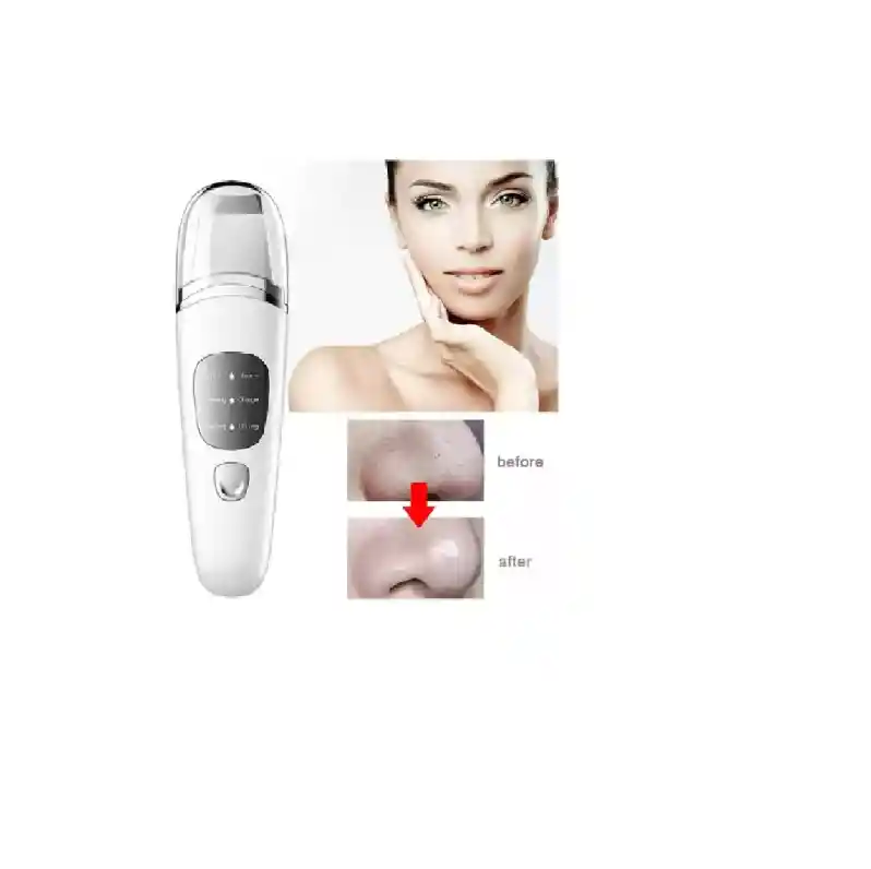 Limpiador Ultrasonido Skin Limpiador Facial