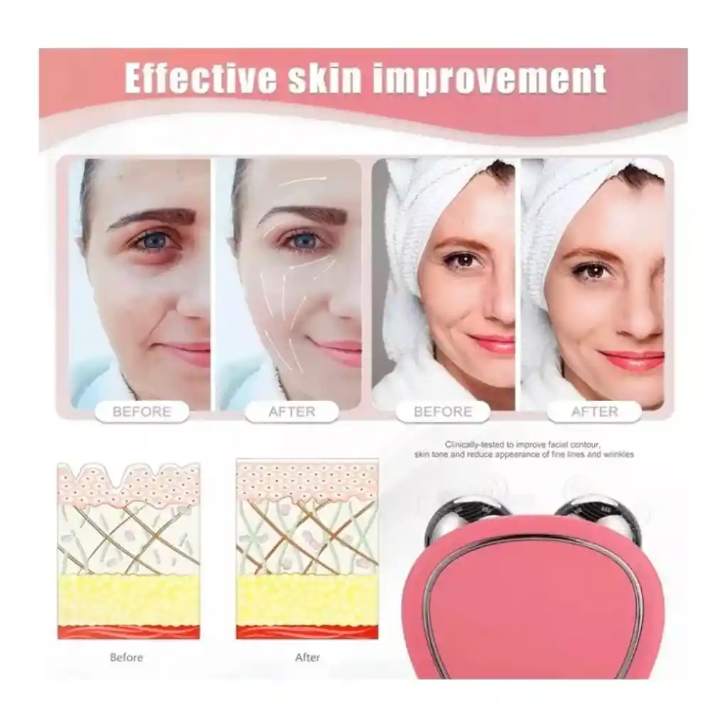 Masajeador Facial Con Microcorriente – Tonifica Y Reafirma La Piel