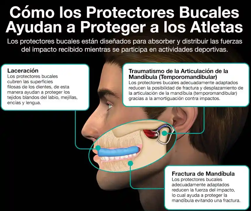 Protector Bucal Miyagi Mouth Guard M3203 Siliconado Sencillo/ Fucsia