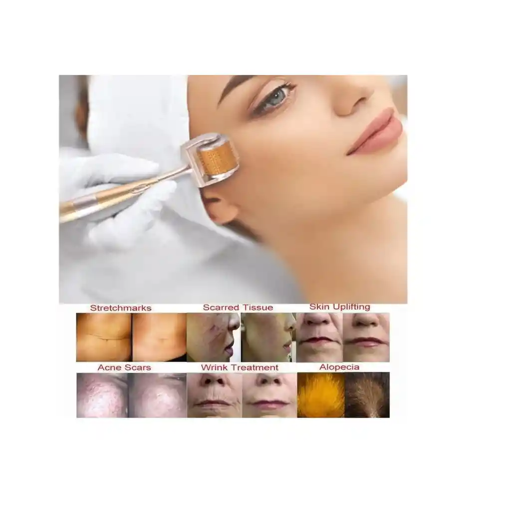 Dermarroller Agujas Titanio Derma Roller 0.50mm Rodillo