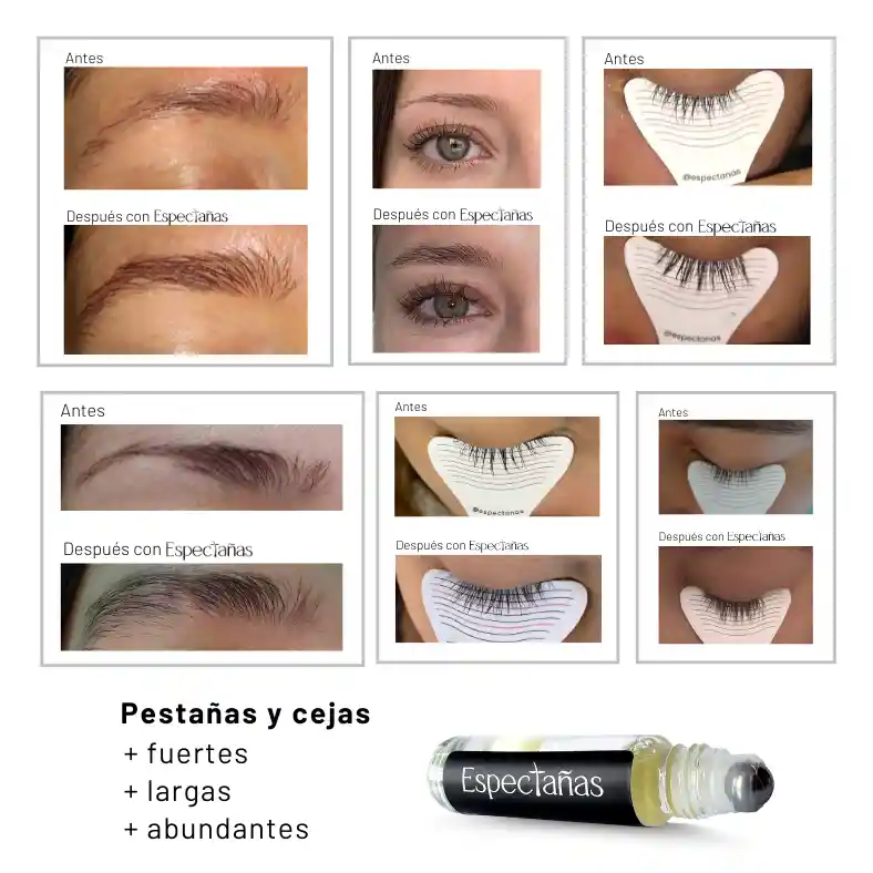 Espectañas