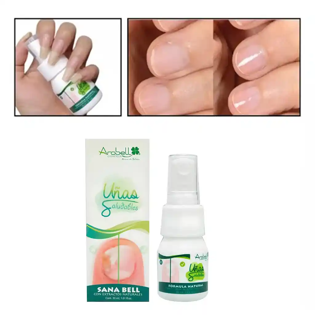 Uñas Saludables Antihongos Sanabell Arobell