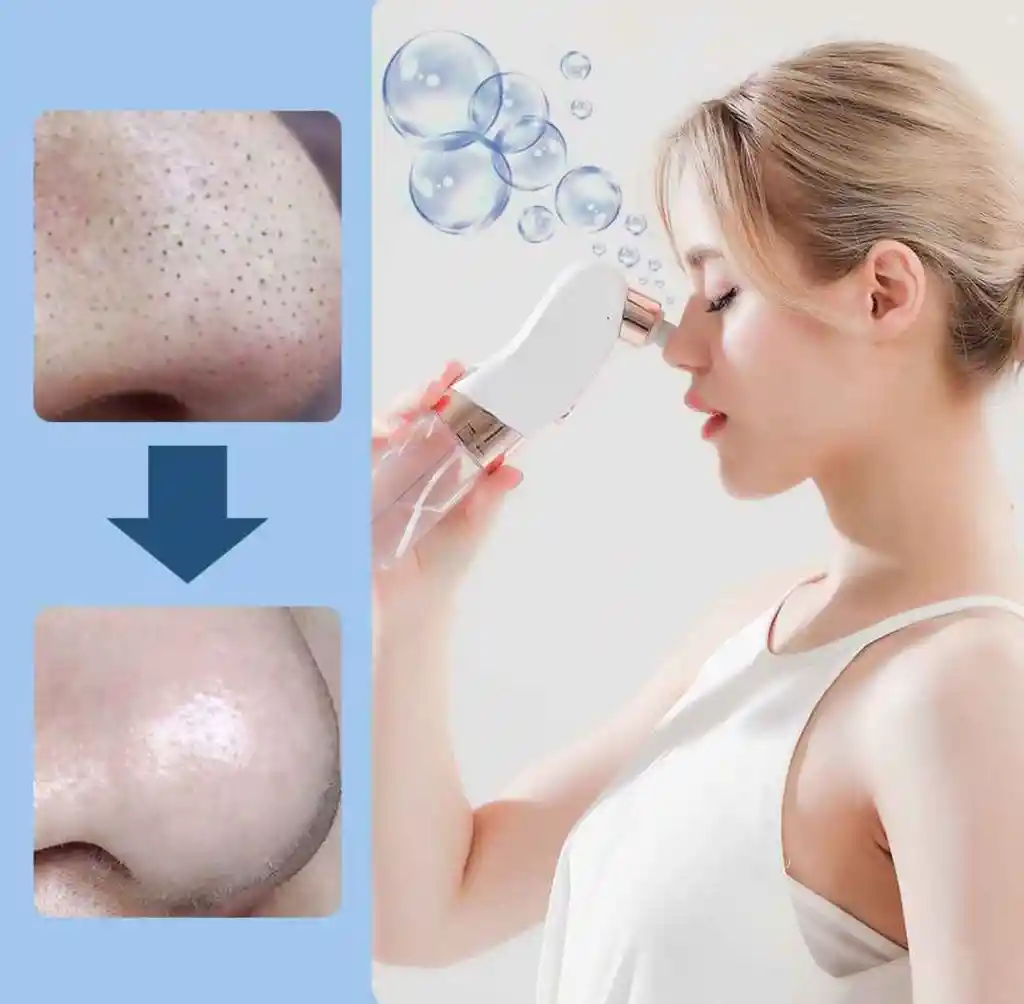 Limpiador Facial Extractor Puntos Negros