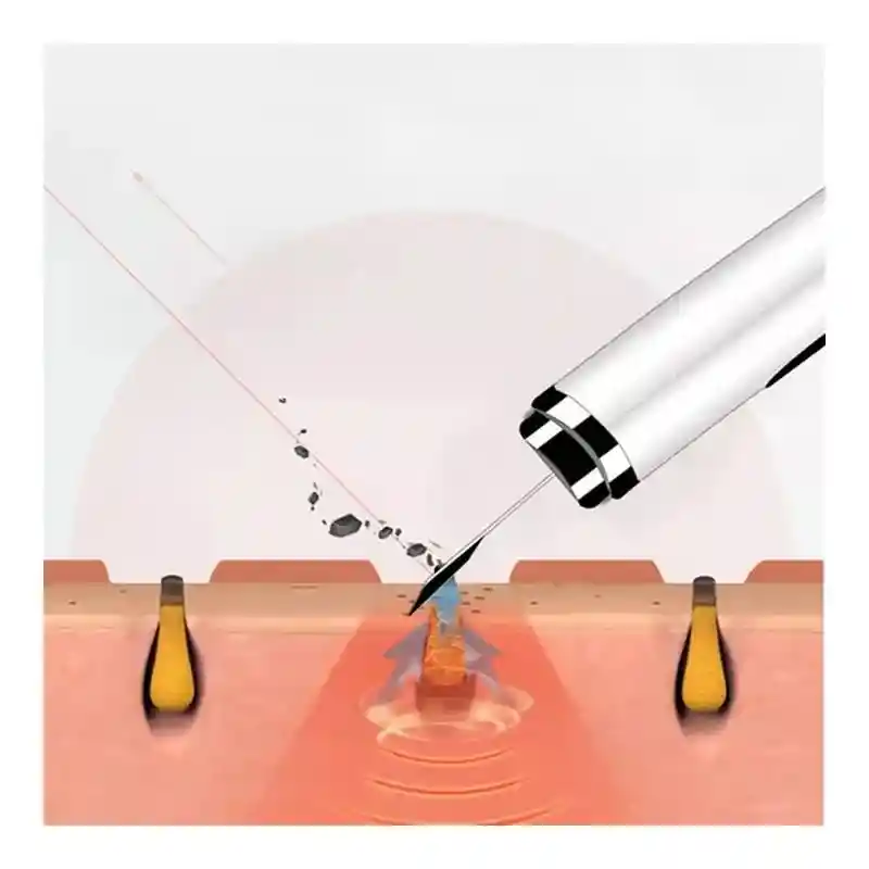 Pala Peeling Ultrasónica Gt1929 Limpiadora De Piel Poros Vibración