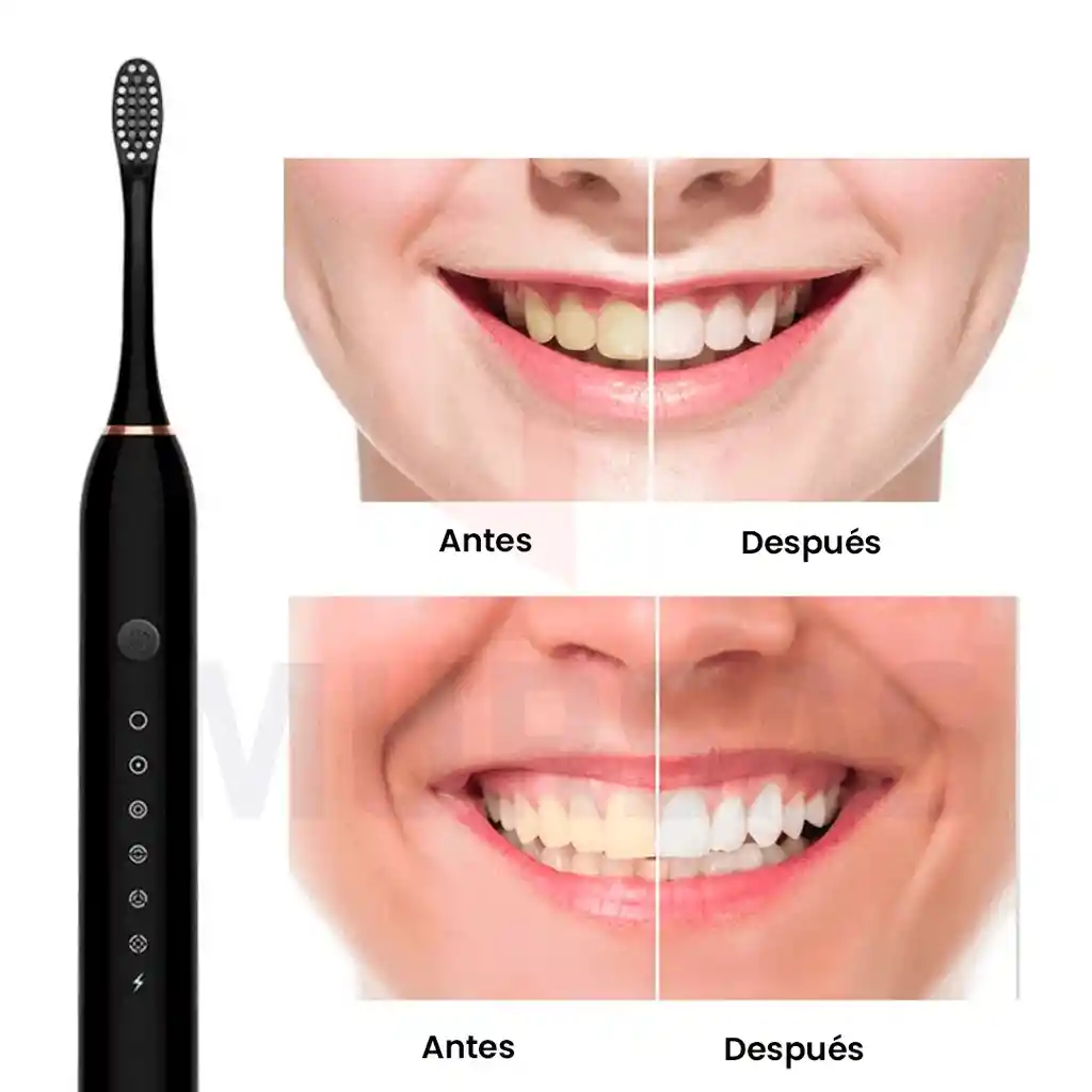 Cepillo De Dientes Eléctrico 4 Cabezales Carga Rápida Negro