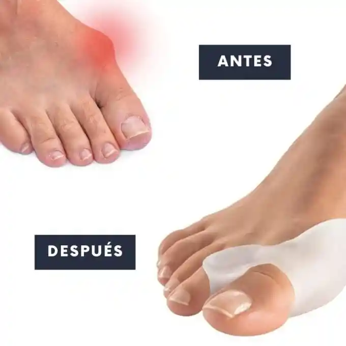 Separador Y Corrector Desviacion Dedos Pie Silicona