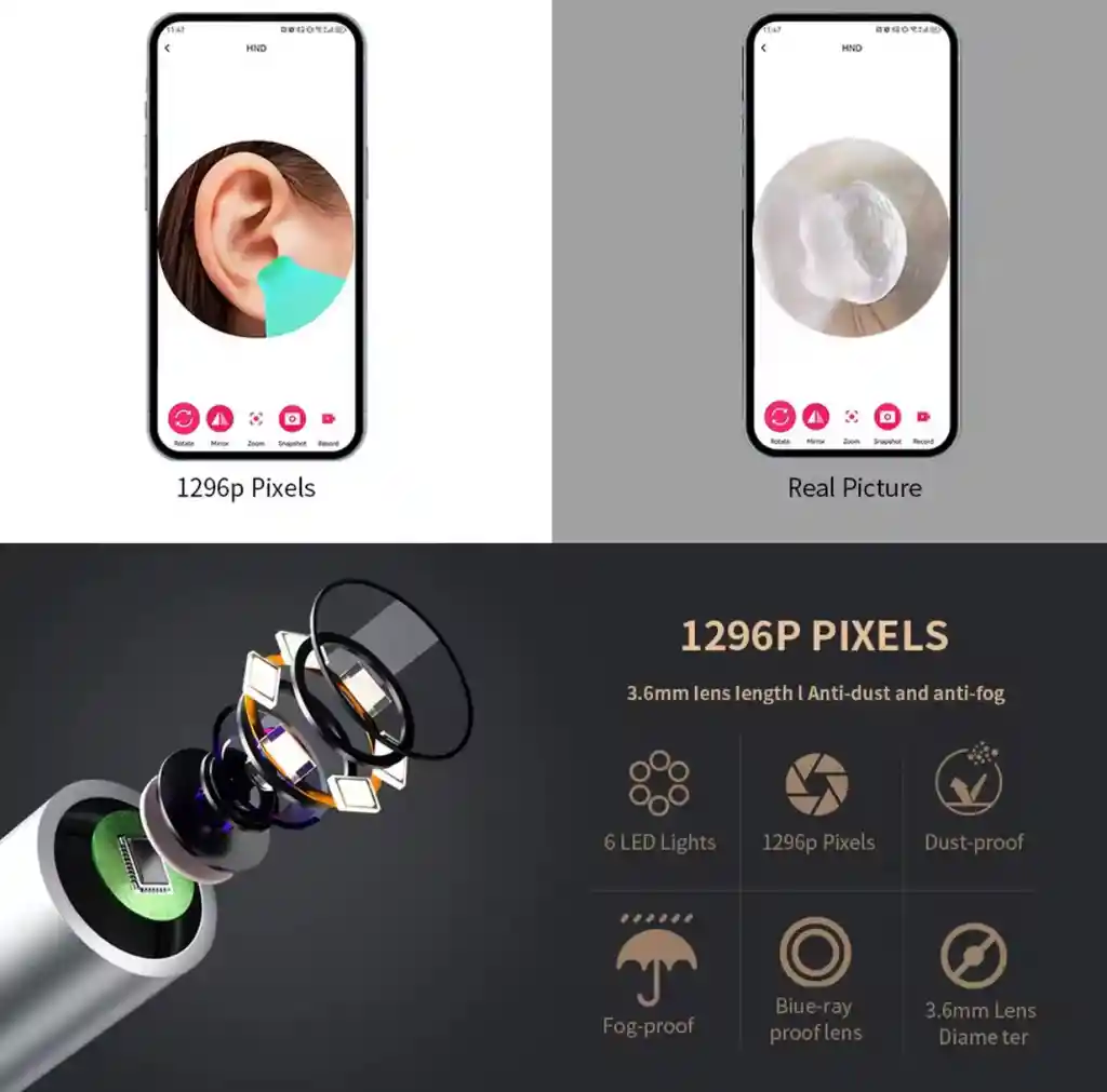 Otoscopio Visual Limpiador De Oídos Inteligente Recargable