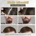 Suero De Minoxidil 5% Para Crecimiento Del Cabello | Unisex, Fortalece Folículos, Previene La Caída