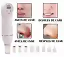 Diamond Peeling Microdermabrasion Para El Cuidado Facial