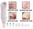 Diamond Peeling Microdermabrasion Para El Cuidado Facial
