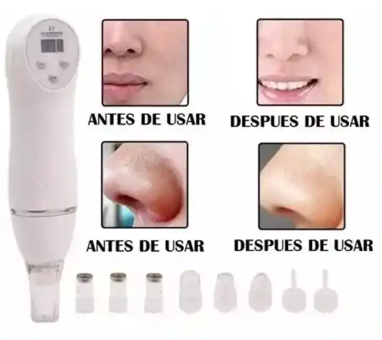Diamond Peeling Microdermabrasion Para El Cuidado Facial