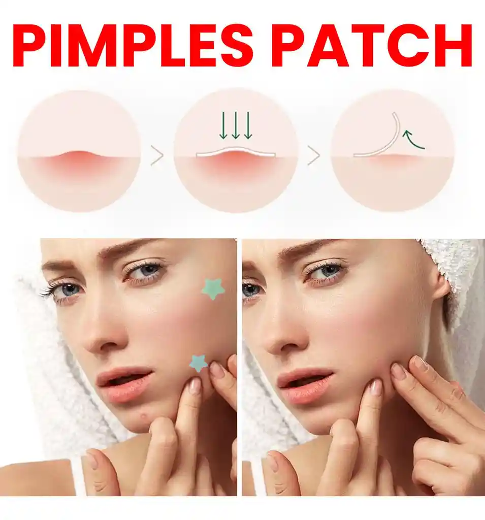 Parches Anti Acne Karite 24 Piezas