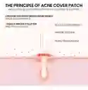 Parches Anti Acne Karite 24 Piezas