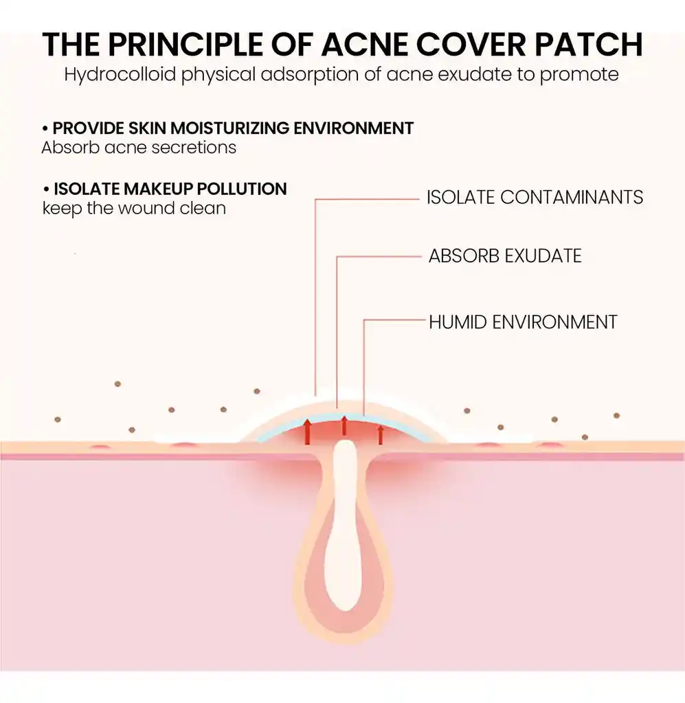 Parches Anti Acne Karite 24 Piezas