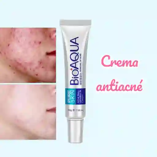 Crema Anti-acne