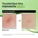Sérum Anti-rojeces Con Ácido Azelaico 10% Y Ácido Hialurónico Anua Azelaic Acid 10 Hyaluron Redness Soothing Serum