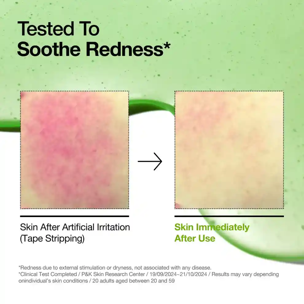 Sérum Anti-rojeces Con Ácido Azelaico 10% Y Ácido Hialurónico Anua Azelaic Acid 10 Hyaluron Redness Soothing Serum