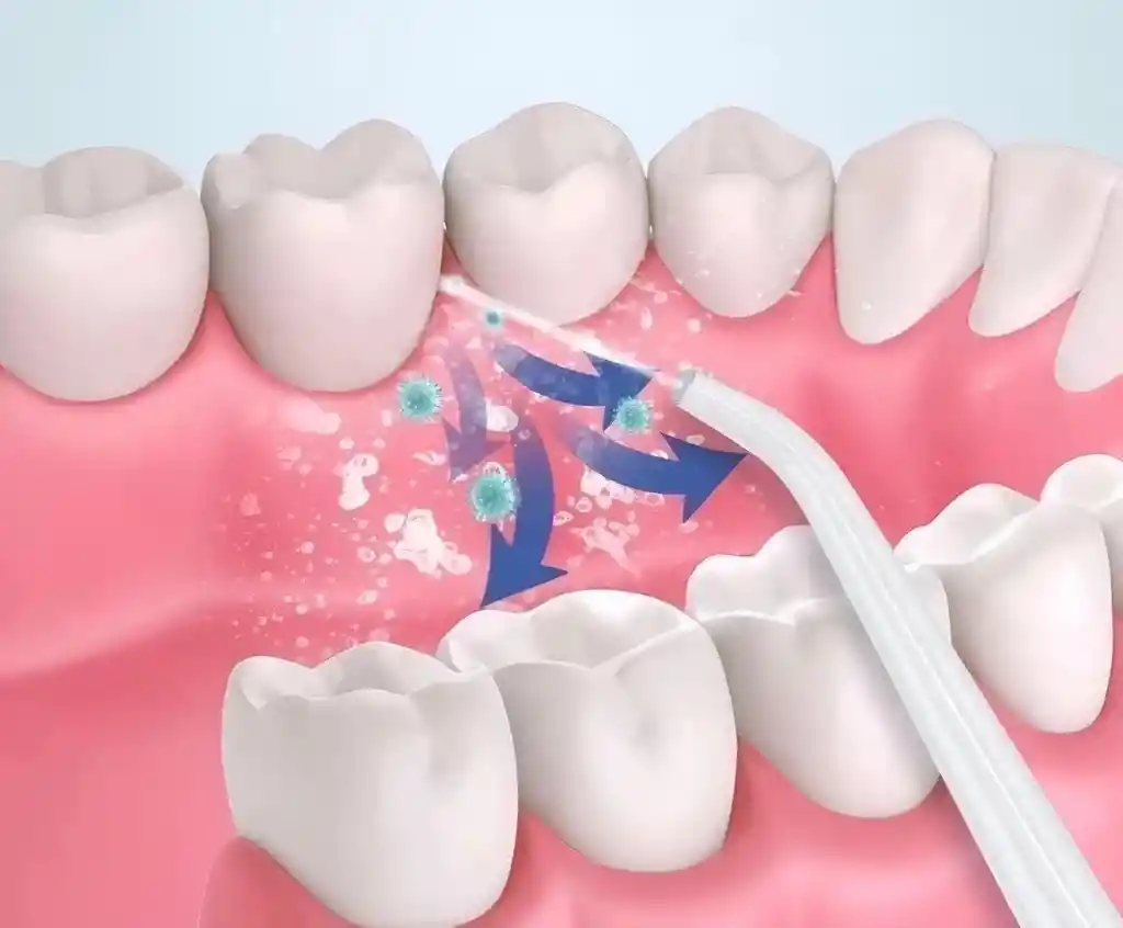 Irrigador Bucal Electrico