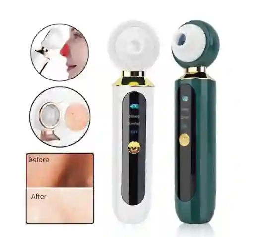 Extractor De Espinillas Y Puntos Negros Recargable Con Lupa Led
