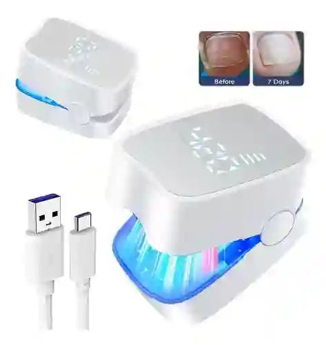 Eliminador Laser Para Hongos En Las Uñas