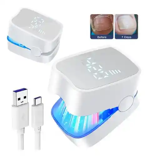 Eliminador Laser Para Hongos En Las Uñas