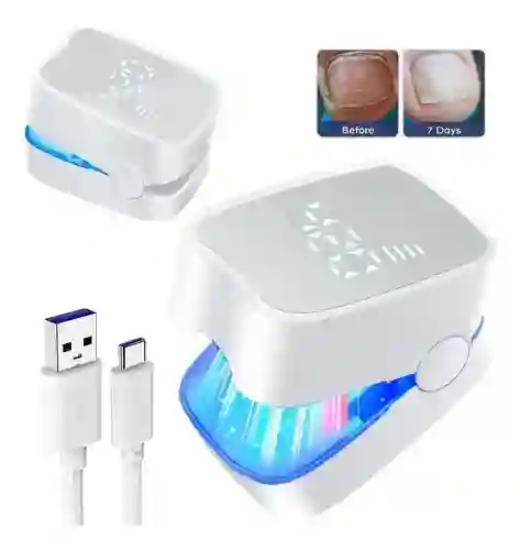 Eliminador Laser Para Hongos En Las Uñas