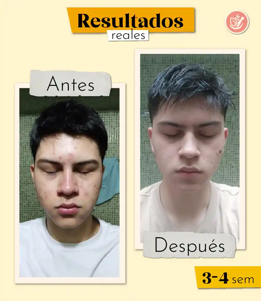 Serum Facial Purificante Santo Remedio