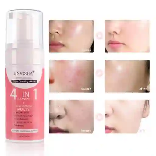 Limpiadora Facial Mousse Para Pieles Grasas Acne