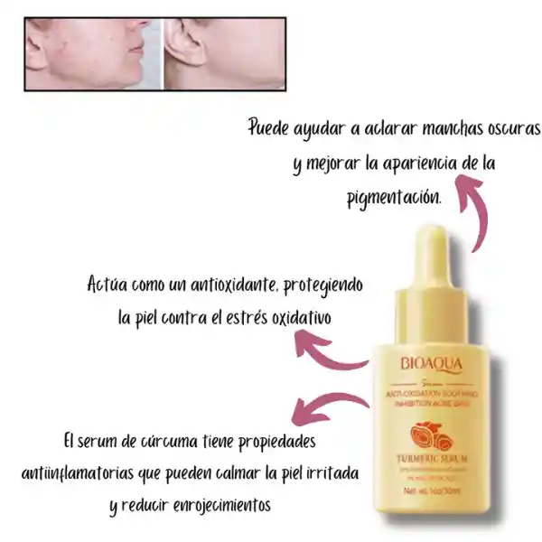 Serum Curcuma Tumeric Bioaqua