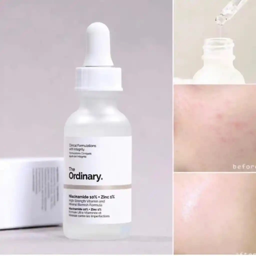 The Ordinary Niacinamida 10% + Zinc 1% 60ml