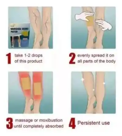 10 Parches Para Varices Mejora Circulacion