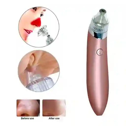 Extractor De Espinillas Y Puntos Negros
