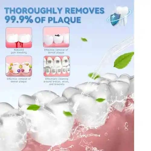Irrigador Limpiador De Dientes Litro 7 Puntas Heyaxa Blanco