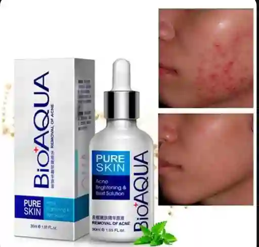 Serum Anti-acne