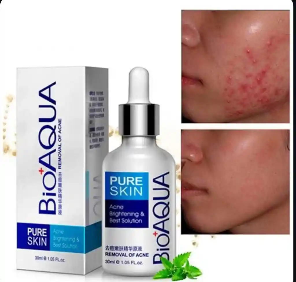 Serum Anti-acne