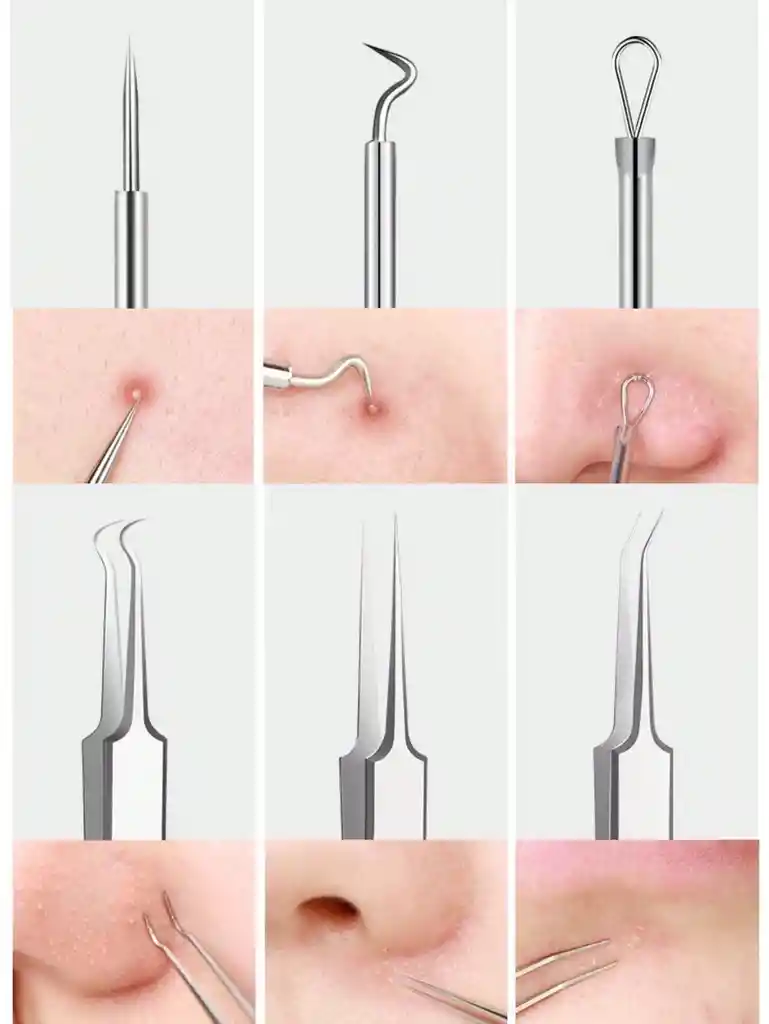 Kit Removedor Extractor Puntos Negros Y Espinillas