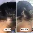 Tónico Anticaída & Acelerador De Crecimiento