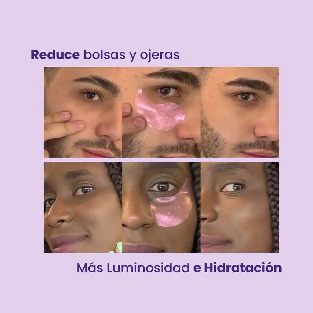 Skinrepublic Parches Para Ojeras Y Bolsas X 15 Pares
