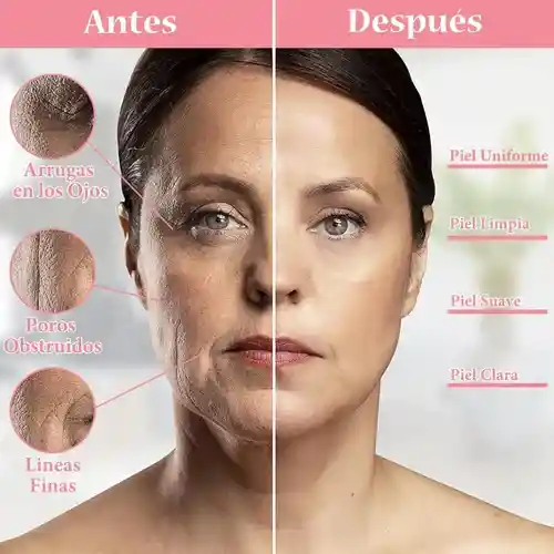 Mascara Fototerapia Led Facial Anti Arrugas Cuello Acné