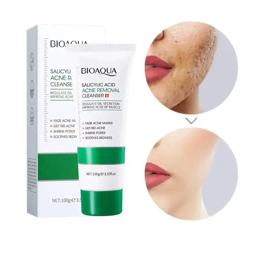 Limpiador Facial Acne Acido Salicilico Bioaqua Ref Bqy56297