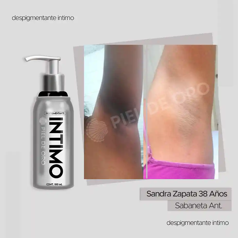 Despigmentante Intimo Piel De Oro