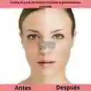 Parches Acne Grano Espinilla Adorno Pegatina