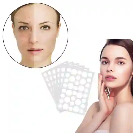 144 Parches Acne Grano Espinilla Adorno Pegatina Piel Cara