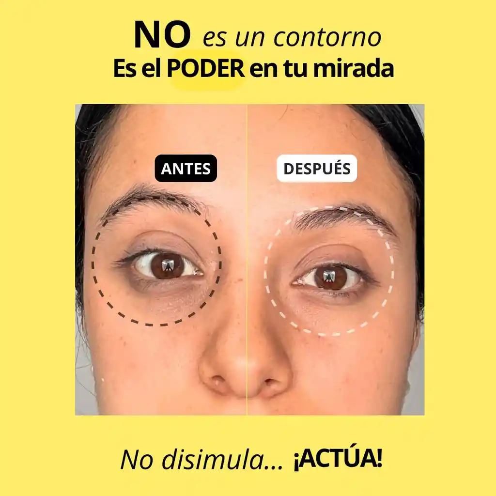 Bye Age Contorno Ojos