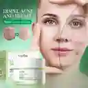 Crema Facial Ácido Salicilico Sadoer 50g