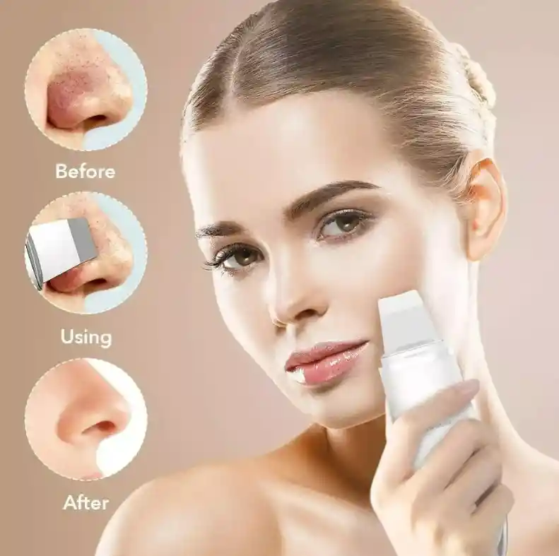 Peeling Scrubber Ultrasonido Skin Limpiador Facial