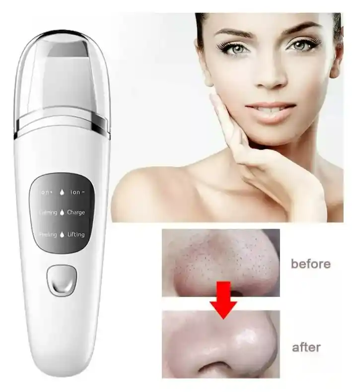 Peeling Scrubber Ultrasonido Skin Limpiador Facial