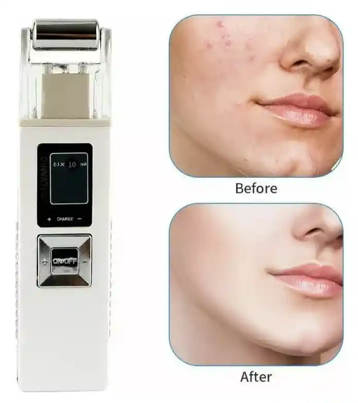 Galvánica Radiofrecuencia Ion M