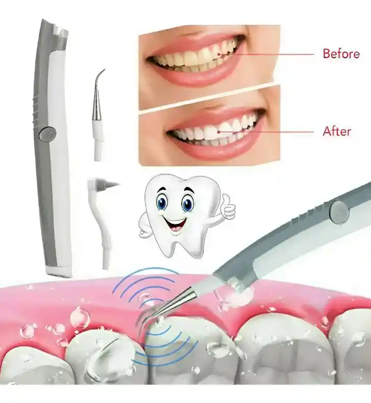 Limpiador Dental Raspador Ultrasónico Quita Sarro Portátil